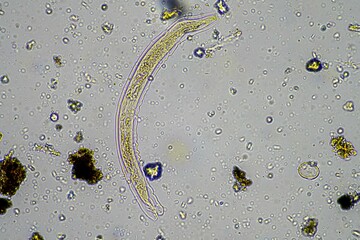 	
soil fungi and microorganisms in a soil and compost sample	
