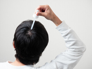 Naklejka premium 育毛剤を塗る男性 後頭部 髪の毛