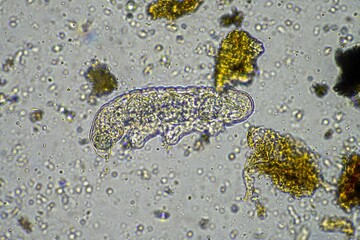 soil microorganisms including microarthropods, micro arthropod, tardigrade, and rotifers a soil sample, soil fungus and bacteria on a regenerative farm in compost. Science under the microscope.