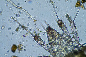 soil parasite in a sample under the microscope on a farm in Australia 