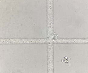 Renal tubular epithelial cell in urine.