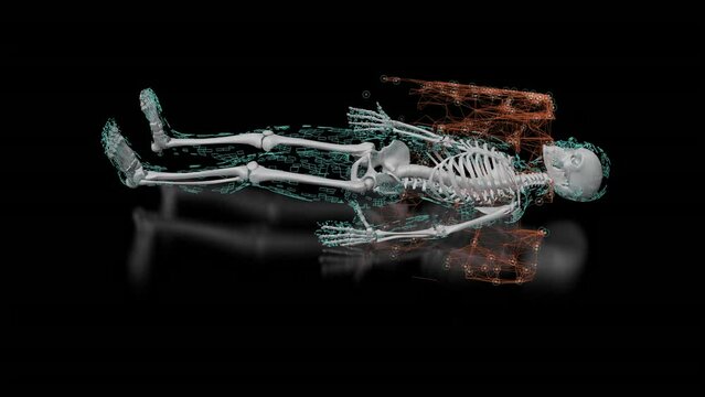 3d Animation illustrating the procedure of a medical bone scan using isotopes. PET CT animation. medical bone scan animation.
