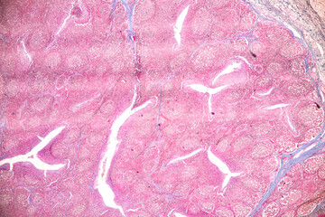 Adipose tissue human, Soft palate human, Bone human and Striated (skeletal) muscle human under the microscope in Lab.