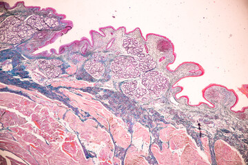 Adipose tissue human, Soft palate human, Bone human and Striated (skeletal) muscle human under the...
