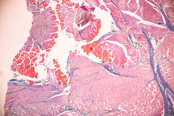 Adipose tissue human, Soft palate human, Bone human and Striated (skeletal) muscle human under the...
