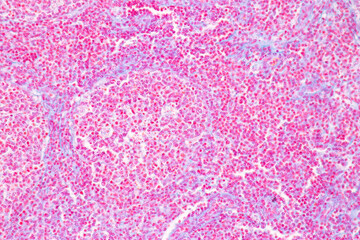 Obraz premium Adipose tissue human, Soft palate human, Bone human and Striated (skeletal) muscle human under the microscope in Lab.