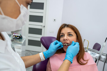 beautiful young patient came to a female dentist for caries treatment.