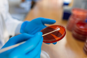 Chemical research in Petri dishes on red background. Preparing plates in a microbiology laboratory....