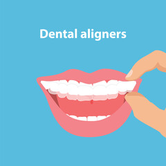 Alignment of teeth by aligners. Orthodontic dentistry concept
