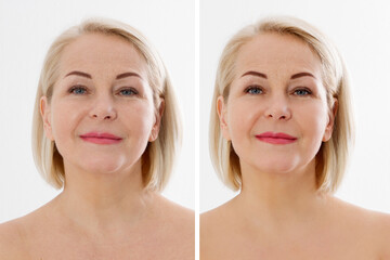 Closeup before after Beauty middle age woman face portrait. Before-after Spa anti wrinkled aging...