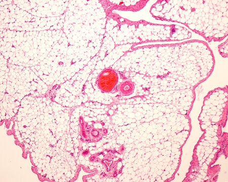White adipose tissue or fat