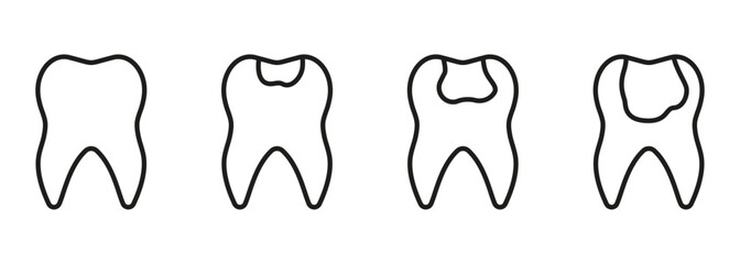 Dental Caries Process Line Icon Set. Dental Filling Sign. Orthodontic Teeth Problem. Tooth Disease Stages Linear Pictogram. Dentistry Outline Symbol. Editable Stroke. Isolated Vector Illustration