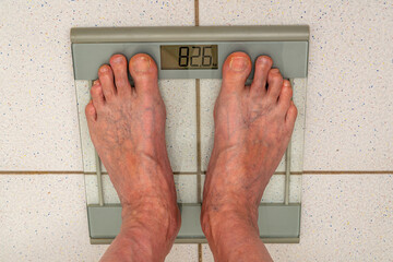 Legs of an elderly man with swollen veins standing on a floor scale.