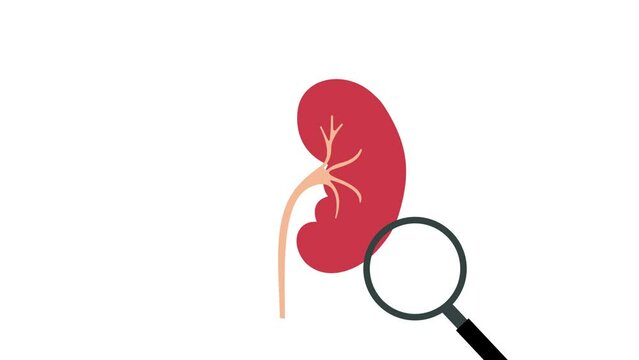 human kidney stone diagnosis medical animation