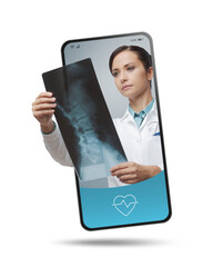 Confident female radiologist checking x-ray image of spinal column.