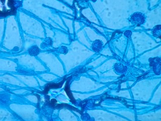 Aspergillus conidiophores stained with lactophenol cotton blue