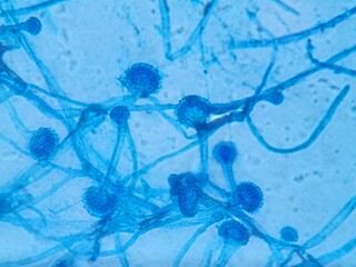 Aspergillus conidiophores stained with lactophenol cotton blue