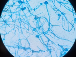Aspergillus conidiophores stained with lactophenol cotton blue