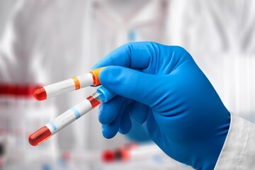 Hand with blood test tube for sample