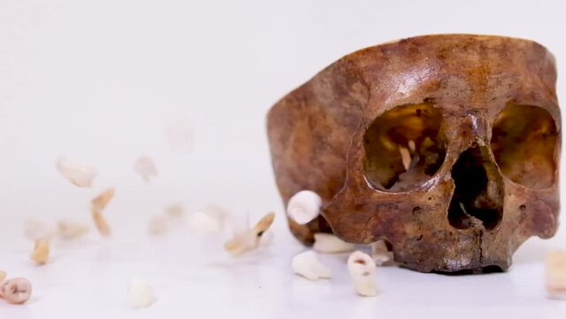 real human skull in section next to the wisdom teeth of real people serve and scatter in different directions dentistry life and death tooth extraction studio white background