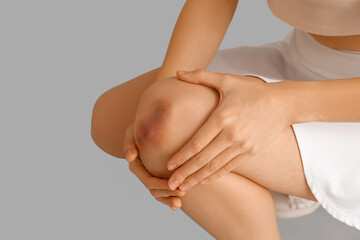 Young woman with bruised knee on grey background, closeup