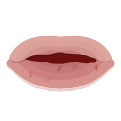 dry lips isolated on white background