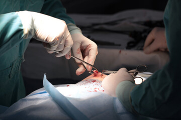 Inguinal hernia. The surgeon applies stitches after laparoscopic surgery. Penetration through the...