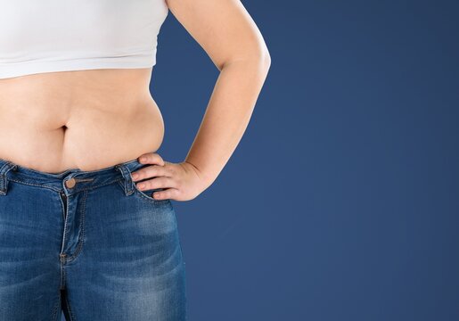 Liposuction Concept, Fat Overweight Woman Body