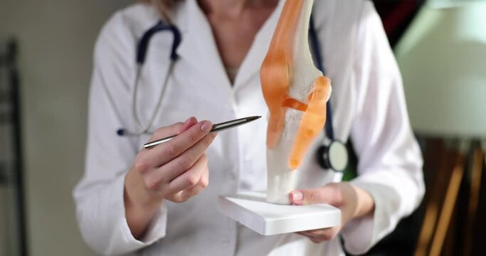 Doctor holds in hands anatomical model of human knee joint in clinic