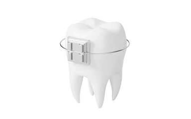 Tooth brace in the white background, 3d rendering.