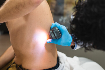 Espalda de hombre siendo examinada por dermatólogo con lupa y linterna - obrazy, fototapety, plakaty