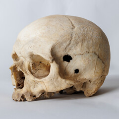 A human skull in profile on a white background.