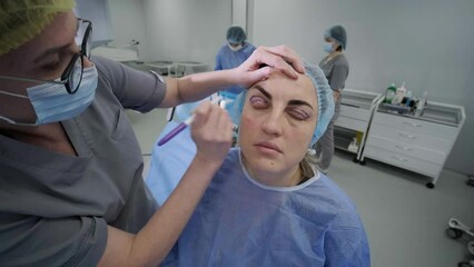 Blepharoplasty plastic surgery operation, focused on rejuvenation and modification of the eye region.