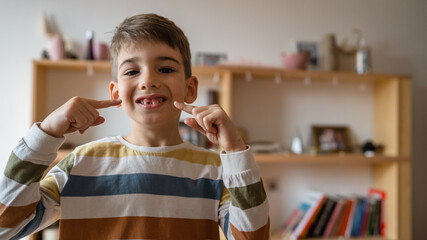 boy with Deciduous primary milk teeth lost tooth fallen out dropped