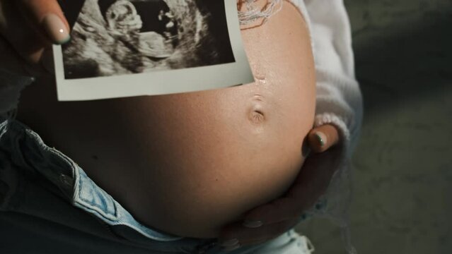 The belly of a pregnant girl in a white bodysuit close-up. Ultrasound scan in a hand. Beautiful natural light	
