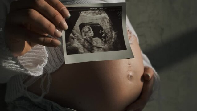 The belly of a pregnant girl in a white bodysuit close-up. Ultrasound scan in a hand. Beautiful natural light	
