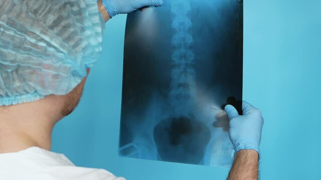 A medical doctor in a white coat in a cap with a sterile medical, analyzes an x-ray of the human spine on a blue background. A medical worker holds an x-ray of the spine of a hernia in his hands