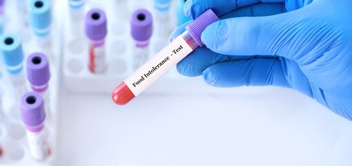 Doctor holding a test blood sample tube with food intolerance test on the background of medical test tubes with analyzes.Copy space for text