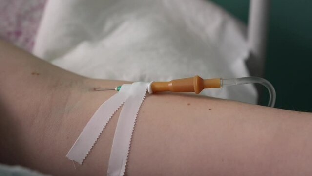 medical dropper and needle inserted into the vein of a female arm. The process of administering drugs intravenously. Pain relief after surgery. Close-up, panorama to the left.