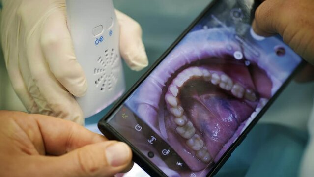 The doctor takes a picture of the patient's teeth and jaw on the phone