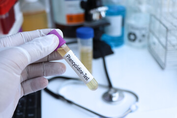 phencyclidine test to look for abnormalities from Urine