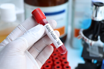 kidney function test to look for abnormalities from blood
