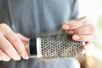 Woman hands holding comb full of hair