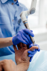 Laser removal of skin pigmentation on male hand. Cosmetology clinic, man during laser cosmetology.