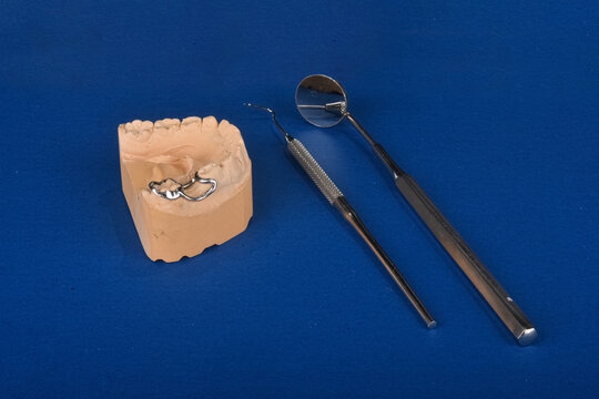 Maintain Space for Permanent Teeth with Space Maintainers: Effective Solution for Kids' Oral Health