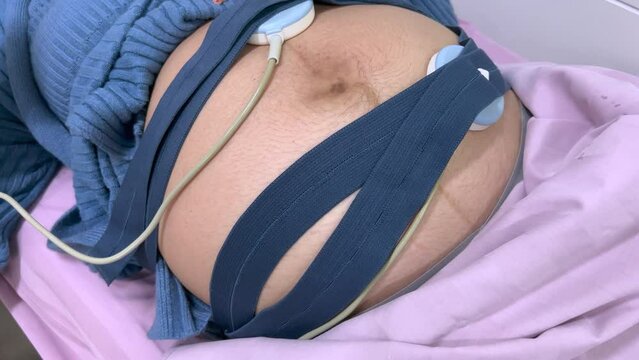 Asian pregnant woman with prenatal ultrasound scan woman wearing fetal monitoring belt