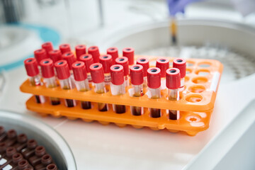 Naklejka premium Rack of blood tubes with barcode labels for proper identification
