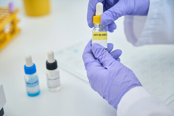 Hematologist holdsa reagent for determining blood group in his hands