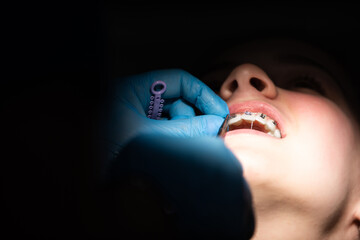 Close up of girl with brackets receiving dental braces treatment in clinic