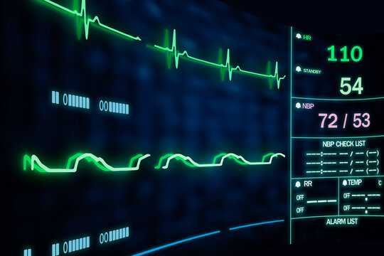 Patient monitor showing vital signs ECG and EKG.